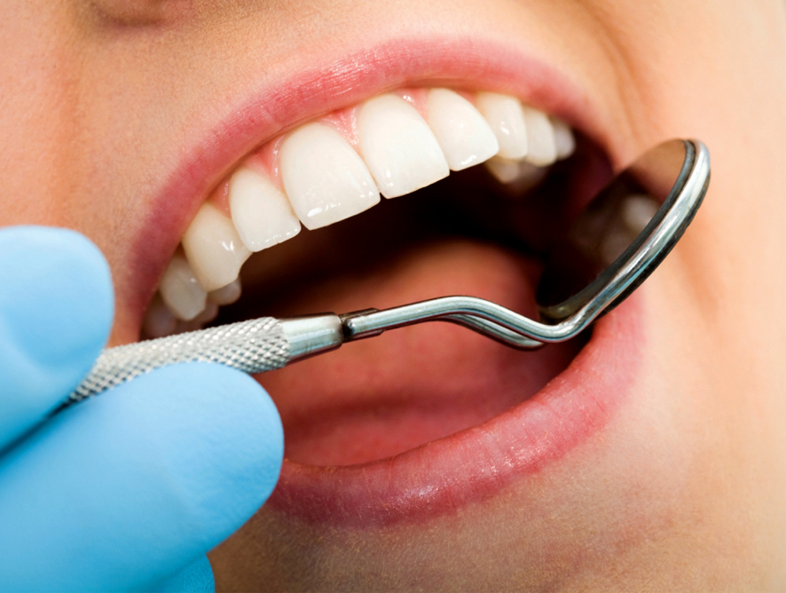 Dépistage des lésions précancereuses